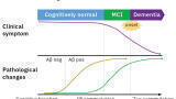 MS detection of Alzheimer’s blood-based biomarkers - From a few drops of blood - the first successful detection of plasma Aβ by MS