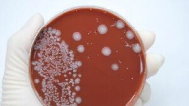 E.coli used for biofuel