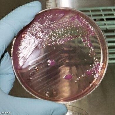 E. coli used to produce biodiesel