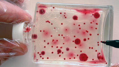 A Test Kit for Microbes in Fuel - an Alternative to IP 385 and ASTM 6974-03