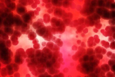 Is Pollution More Dangerous for Certain Blood Types?